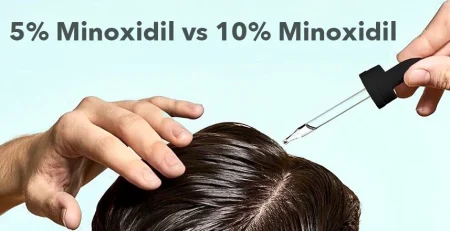 5-minoxidil-vs-10-minoxidil
